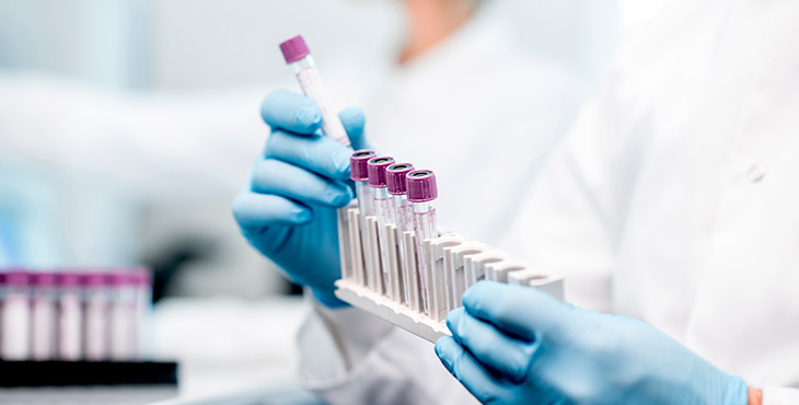 Câmara aprova revisão da tabela do SUS para inclusão de novos exames laboratoriais